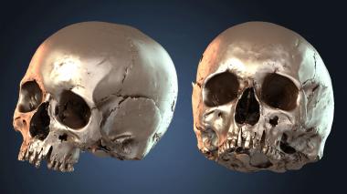 3D model Human Skull (STL)