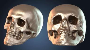 3D model Old Skull (STL)