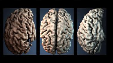 3D model Brain (STL)