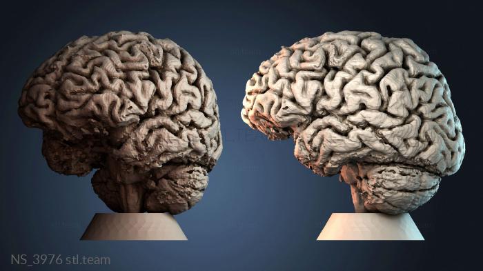 Нестандарт NS_3976