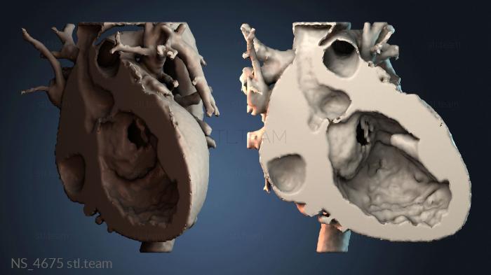 Нестандарт NS_4675