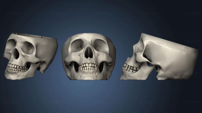 3D model Dr Brain real skull smoothed (STL)